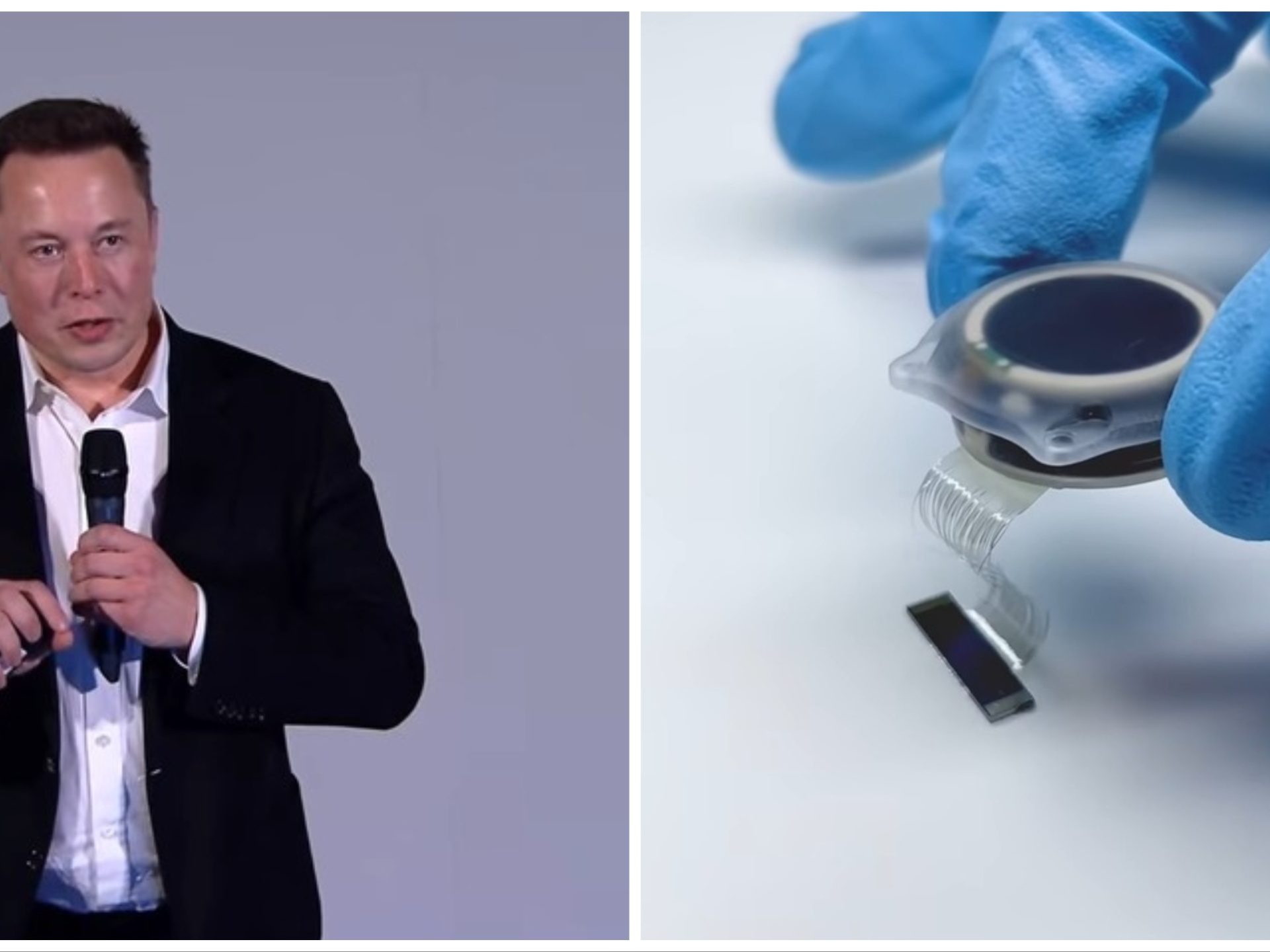 Musk cerca cavie umane per testare il chip cerebrale: nei test sono morti 1.500 animali