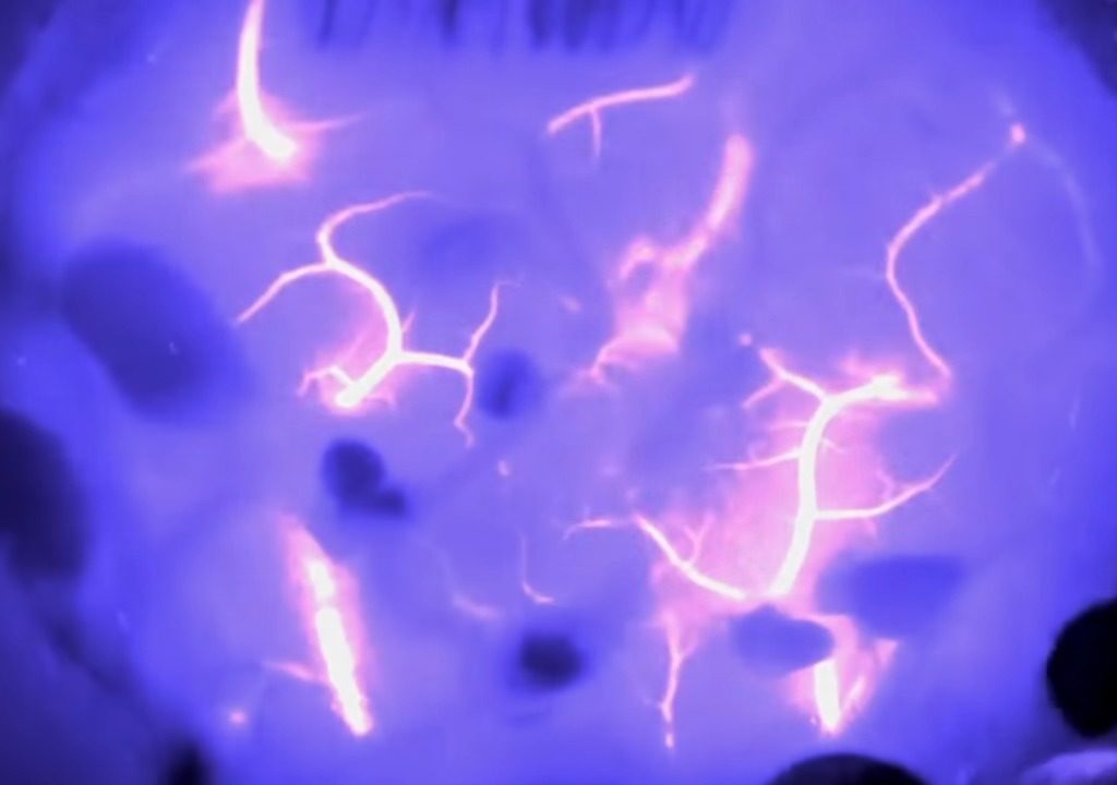 Musk cerca cavie umane per testare il chip cerebrale: nei test sono morti 1.500 animali