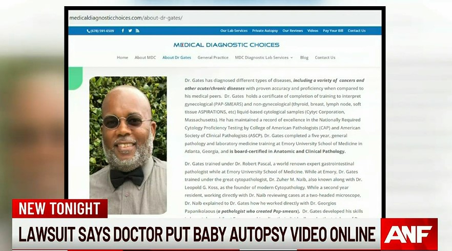 Bimbo decapitato durante il parto, medico mette l'autopsia online: denunciato