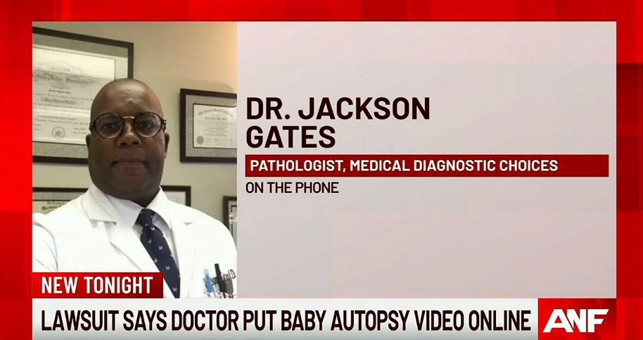 Bimbo decapitato durante il parto, medico mette l'autopsia online: denunciato