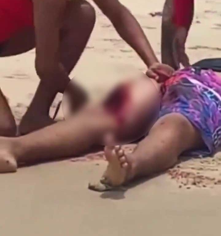 Madre si fa sbranare da squalo per salvare figlia di 5 anni: terrore in spiaggia