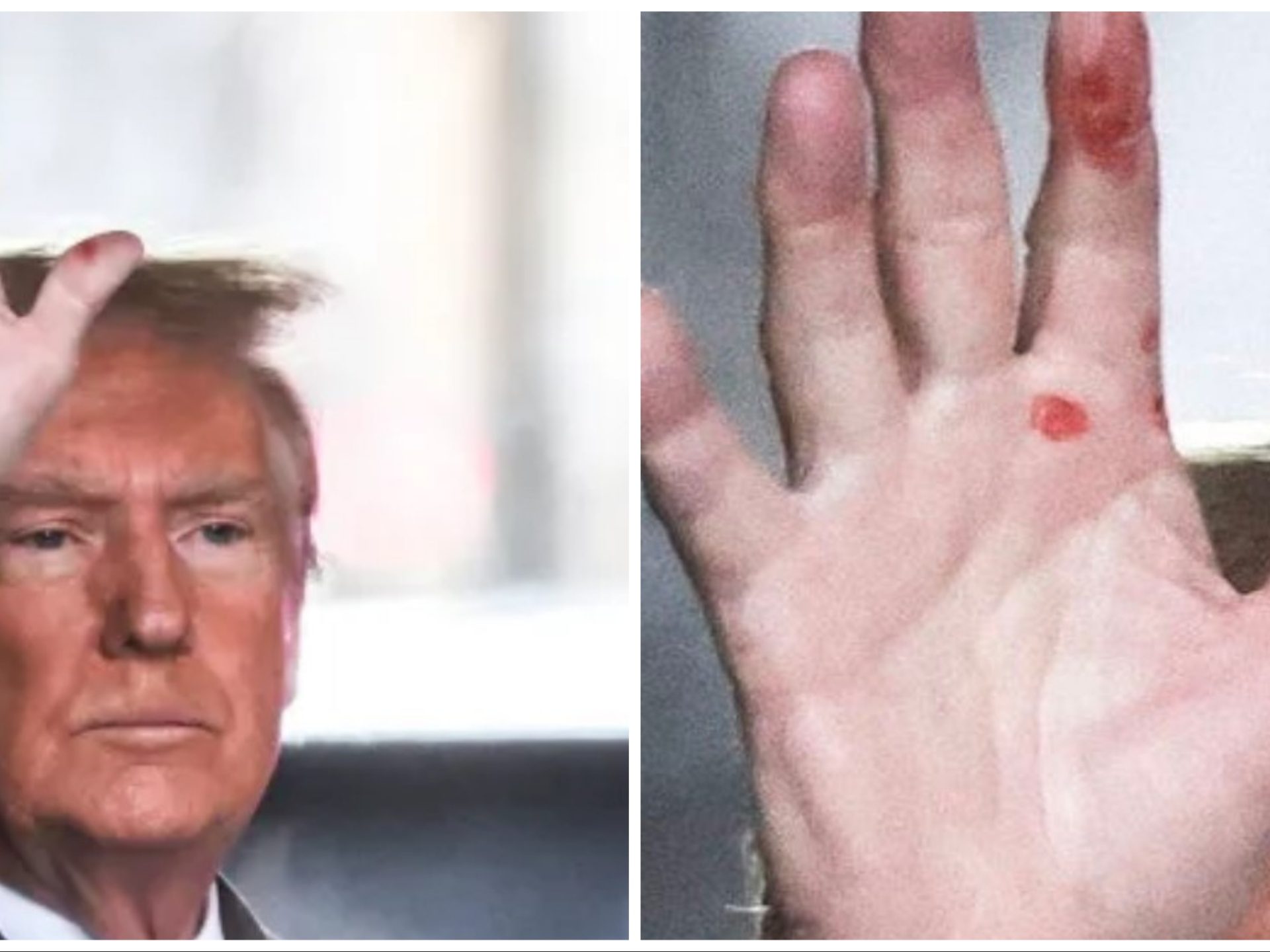 "Trump ha la sifilide": la mano macchiata aprono dubbi sulla sua salute