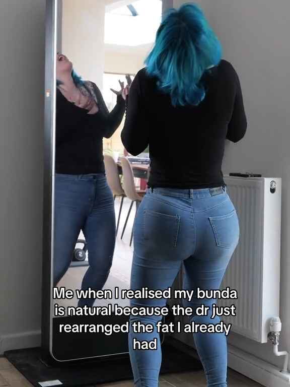Modella con protesi al sedere gigante scopre che non può avere i jeans