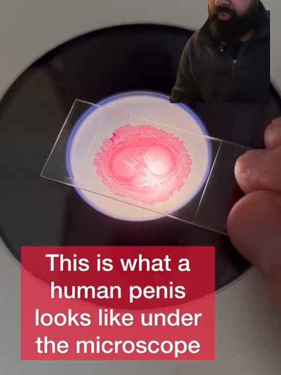 Una fetta di pene passato al microscopio: video scientifico fa il botto