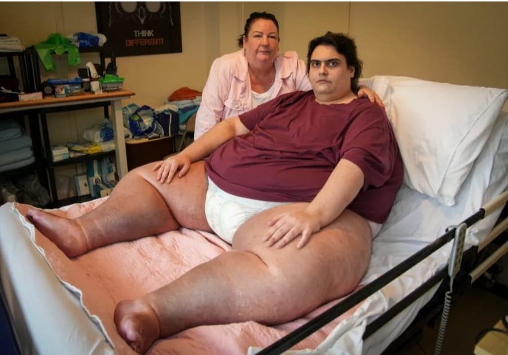 Morto l'uomo più obeso d'Inghilterra: non si riesce a cremarlo, forni troppo piccoli