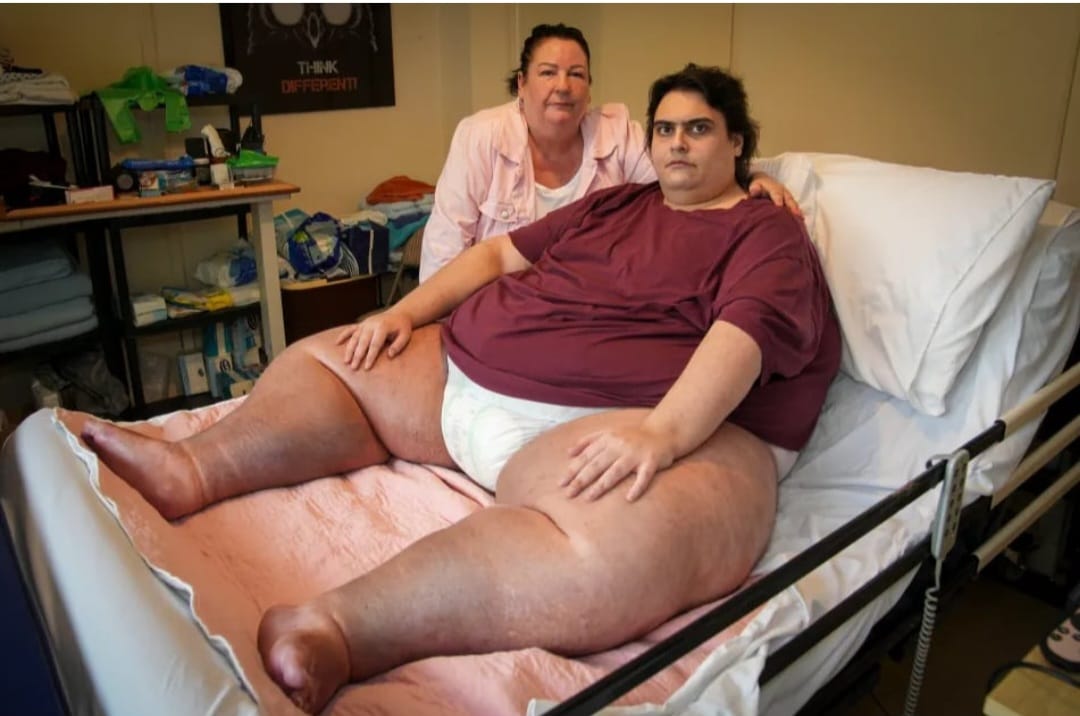 Morto l'uomo più obeso d'Inghilterra: non si riesce a cremarlo, forni troppo piccoli